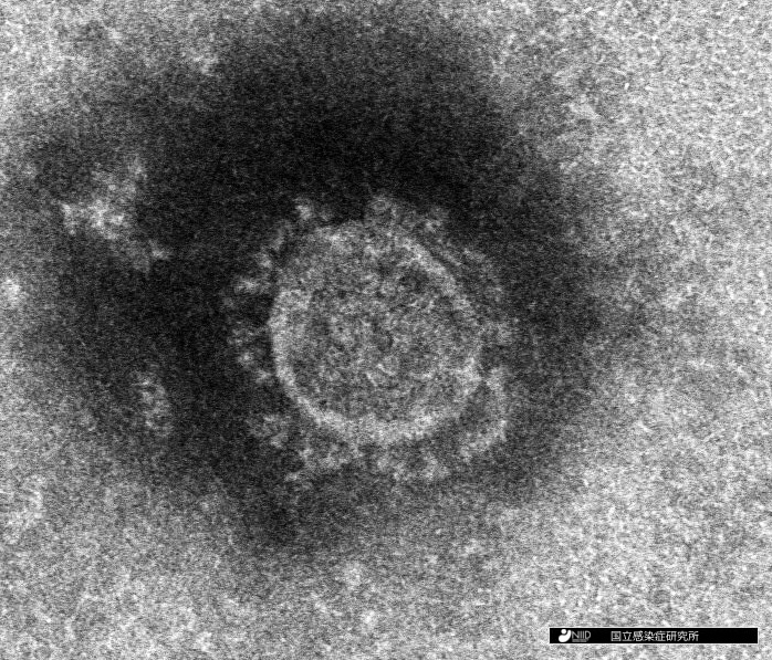 国立感染症研究所で分離された <br />新型コロナウイルスの電子顕微鏡写真 　（提供元：国立感染症研究所）